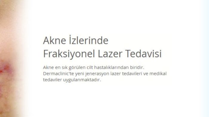 Bursa’da Sivilce ve Akne İzlerine Kalıcı Çözüm Dermaclinic’te