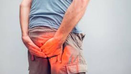 Lazer Hemoroid Tedavisi Nasıl Uygulanır ve Avantajları Nelerdir?