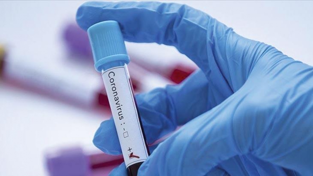 Toplam doğrulanmış vaka sayısı 2.609.359 iken koronavirüs ölümleri 27.738'e ulaştı